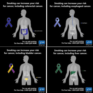 CDC Tobacco Free: Rainbow Man Social Media Bundle: details >>