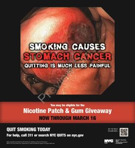 Painful Cancers - Stomach Cancer - Full Page: details >>