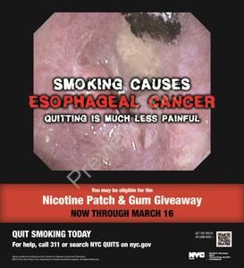 Painful Cancers - Esophageal Cancer - Full Page: details >>