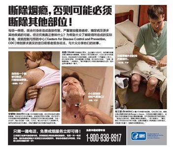 Advertorial, Excision - Simplified Chinese: details >>